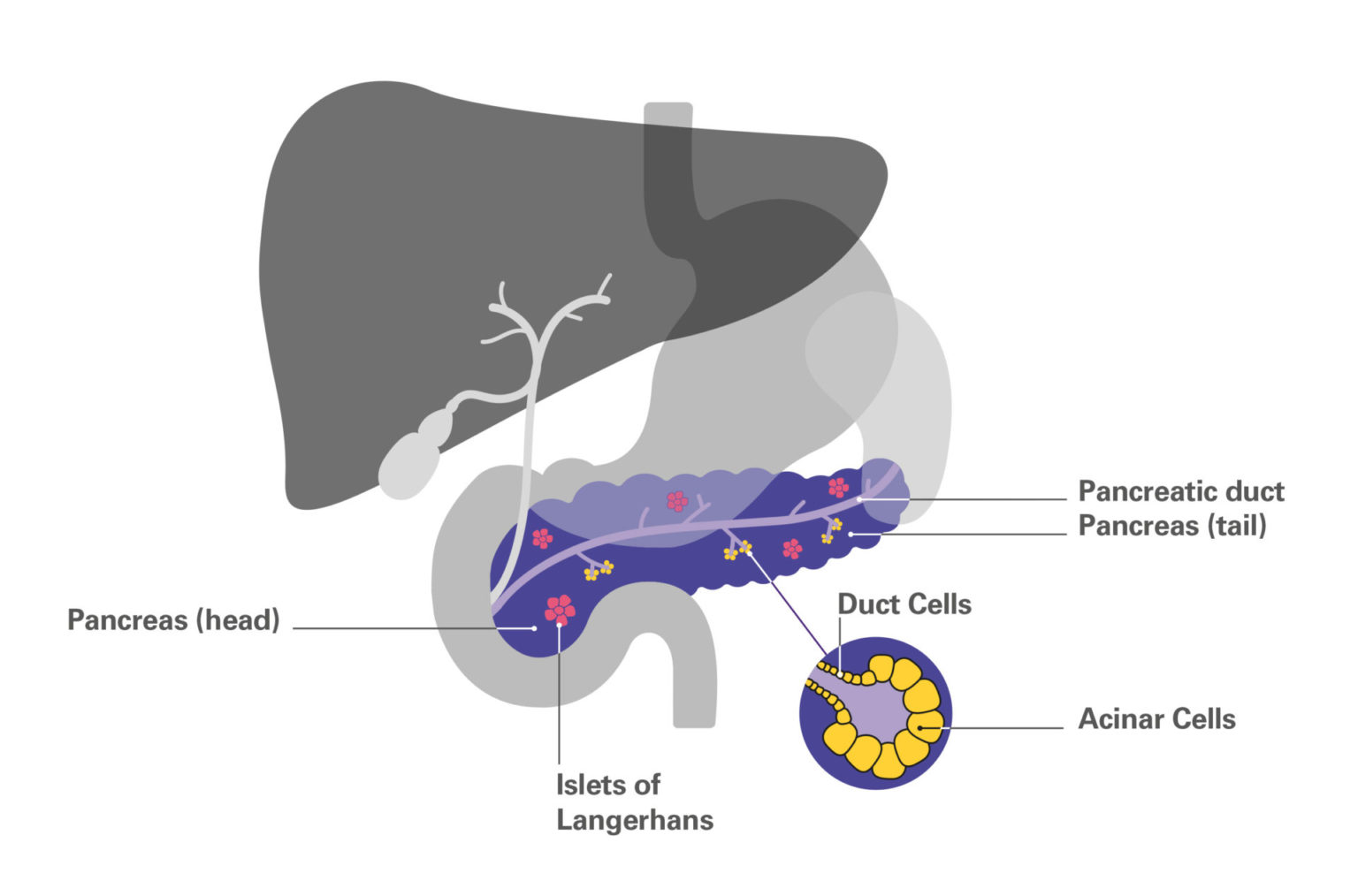 Types Of Pancreatic Cancer Pancreatic Cancer Uk 0782