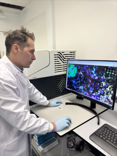 Male researcher looks at computer screen that shows a molecular map of a pancreatic cyst