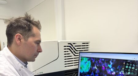 Male researcher looks at computer screen that shows a molecular map of a pancreatic cyst